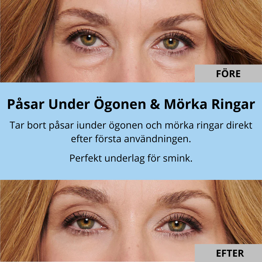 EyeLift - Eliminerar påsar under ögonen & rynkor