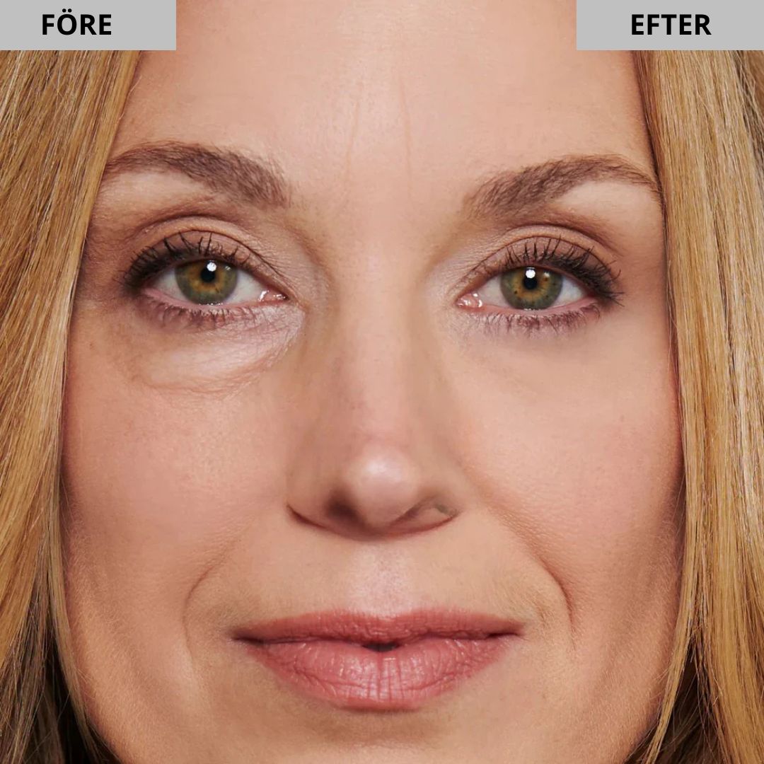 EyeLift - Eliminerar påsar under ögonen & rynkor