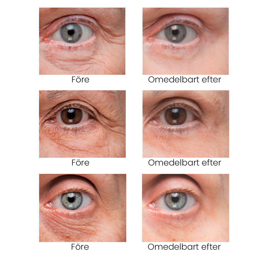 EyeLift - Eliminerar påsar under ögonen & rynkor